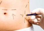 cirurgia-plastica-em-santana-1432152678